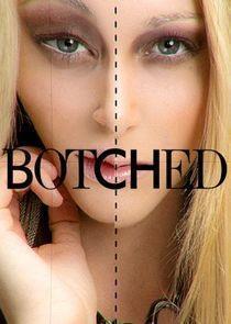 Botched Season 3 cover art