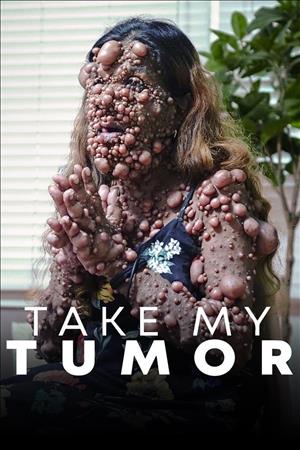 Take My Tumor Season 1 cover art